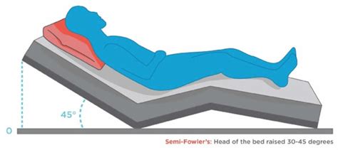 Fowler’s position, uses for Fowler’s position