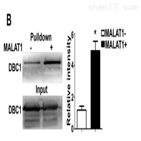 RNA Pulldown、DNA Pull-down原理及步骤_外包技术服务-上海研谨生物科技有限公司