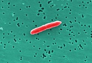 Free picture: small, grouping, gram, negative, sebaldella termitidis, bacteria