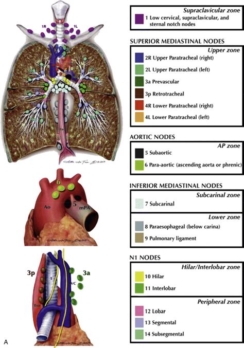 Mediastinal Lymph Nodes