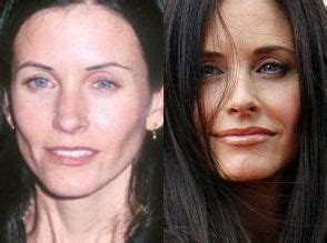 STARS WITHOUT MAKEUP | Celebrity plastic surgery, Lip injections, Plastic surgery