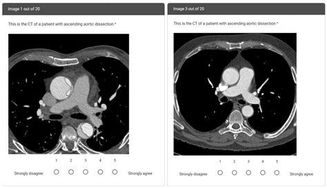 Tomography | Free Full-Text | Comparing the Diagnostic Performance of ...