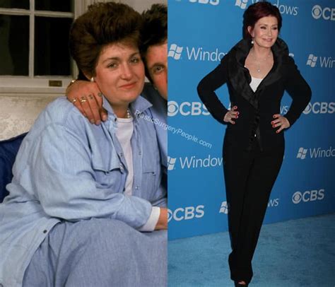 Sharon Osbourne: BEFORE and AFTER