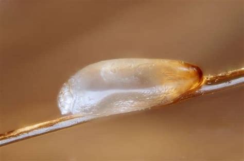 Dead vs Live Nits: Color of Lice Eggs - My Lice Advice