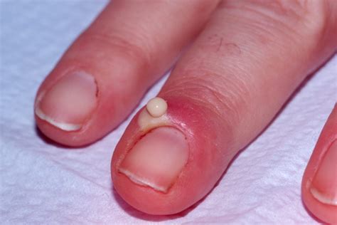 15 Health WARNINGS Your Fingernails Are Sending