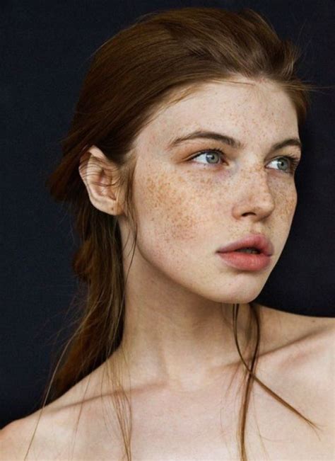 a woman with freckles on her face and shoulder