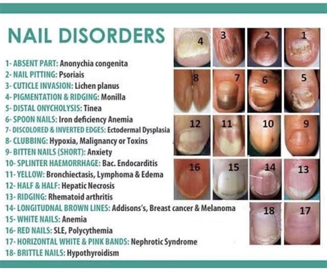 Pin by Lulalu7984 on Dr. /paramedic/nursery | Nail disorders, Nail ...