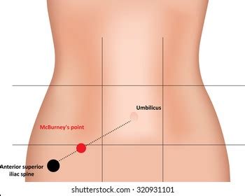 7 Mcburney's Point Images, Stock Photos, and Vectors | Shutterstock