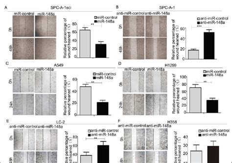 Wound-healing assay. (A-F) Wound-healing assay for SPC-A-1sci, H1299,... | Download Scientific ...