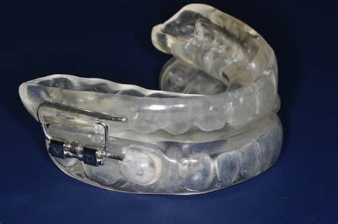 Sleep Apnea and Snoring Devices - North Seattle Dental