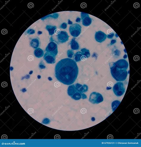 Mesothelial cells stock image. Image of disease, hemoglobin - 67926131