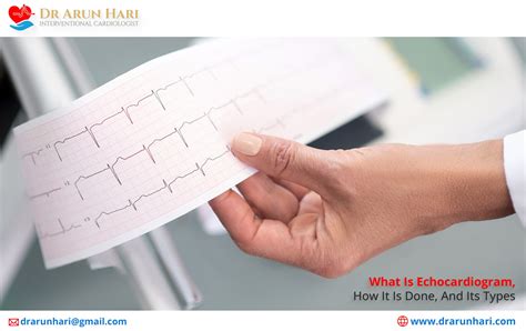 Echocardiogram Types and Procedure - Dr Arun Hari