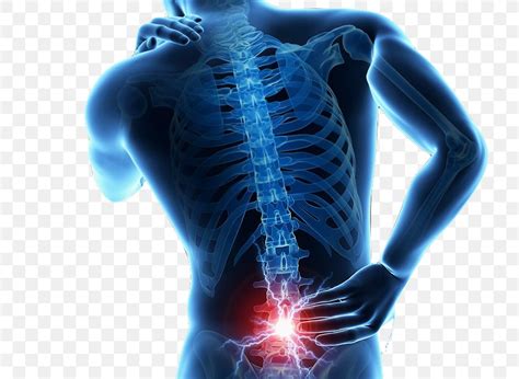 Low Back Pain Human Back Back Injury Vertebral Column, PNG, 800x600px ...