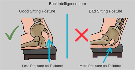 Tailbone Pain Exercises / No Turning Back: Reduce Back Pain with These Spine ... / Since the ...