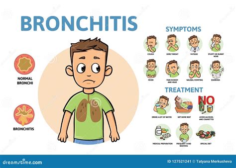 FUE Treatment Infographic For Men Vector Illustration | CartoonDealer ...