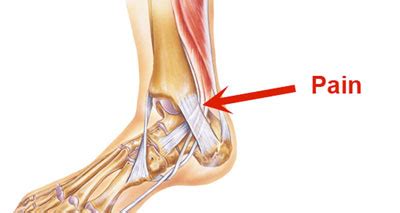 Inside Ankle Pain (Medial) - Symptoms, Causes, Treatment & Rehab