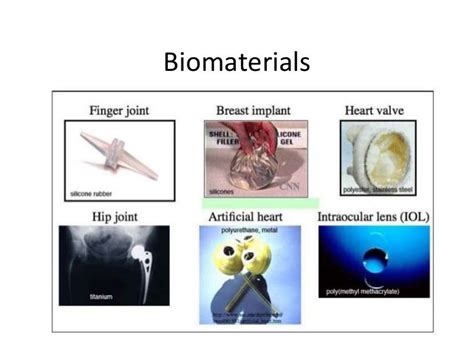 Biomaterials 2010