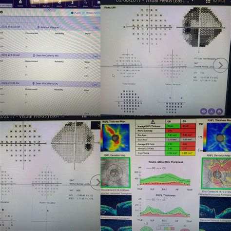 New IOP indicates trouble: IOP CATS/GAT OD= 16/14 OS= 24/17 : r ...