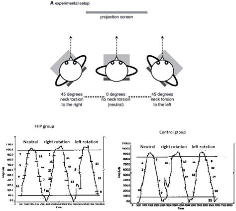 In A, an example of the smooth pursuit neck torsion test (SPNT) is... | Download Scientific Diagram