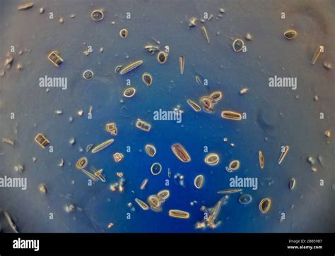 Diatom diversity, Amphora, Cocconeis, Cyclotella, Diatoma, Cymatopleura, Synedra, Melosira ...