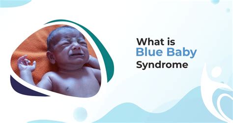 Blue Baby Syndrome | Best Pediatrics Cardiologist in Bhagalpur