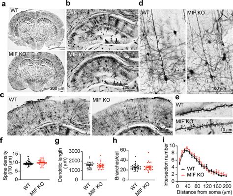 Characterization of dendritic spine density and neuronal morphology in ...