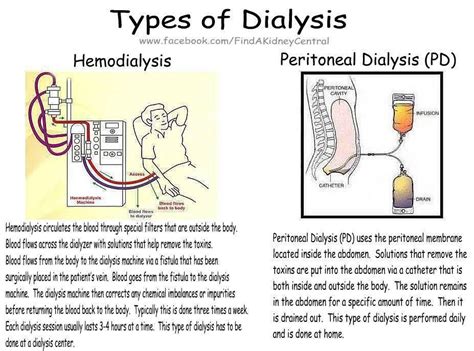 Frequent Kidney Infections Causes | Dialysis nurse, Dialysis, Surgical nursing