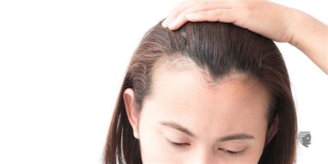 Traction Alopecia: Symptoms, Prevention and Treatment - AHS India