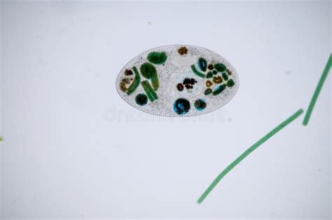 Frontonia sp. unicellular ciliate protists under the microscope. Frontonia sp. i , #Aff, # ...