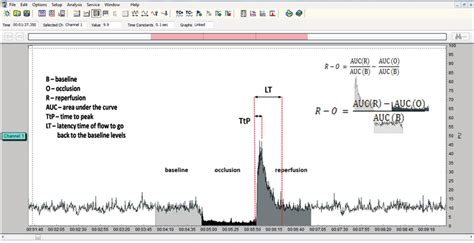 Laser Doppler Flowmetry (LDF) measurement of skin microvascular blood ...