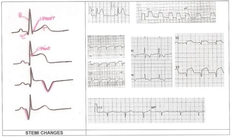 More Instructor Resources | ECG Guru - Instructor Resources