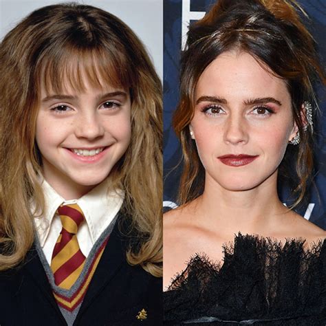 Photos from See the Kid Stars of Harry Potter Then and Now - E! Online