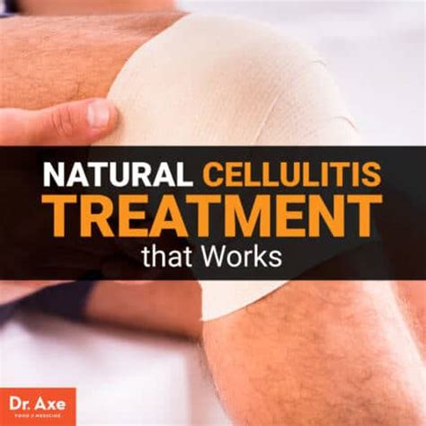 Cellulitis Treatment: Natural Remedies & Prevention Tips - Dr. Axe