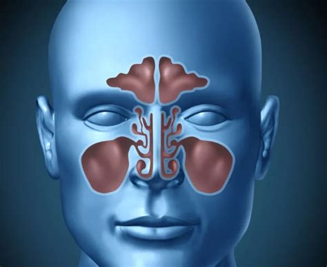 Chronic Bacterial Sinusitis can be Prevented by Daily Nasal Rinsing with Saline Solution, Study ...