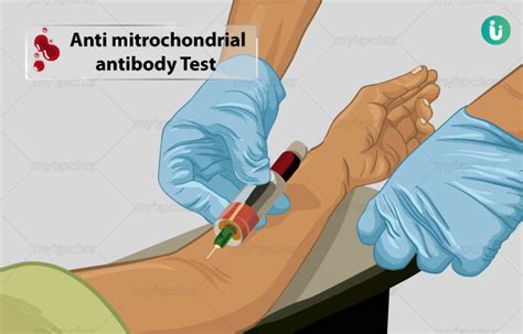 Antimitochondrial antibody (AMA) Test: Procedure, Purpose, Results, Cost, Price, Online booking