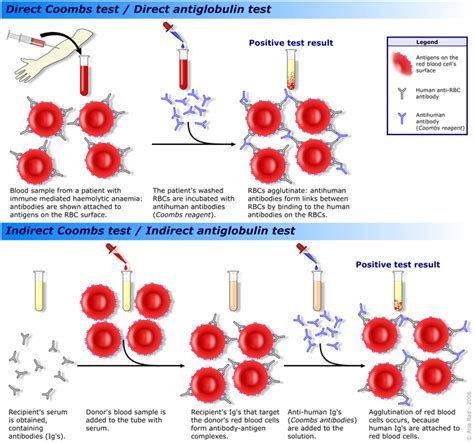 Precipitation Reaction Of Antigen And Antibody