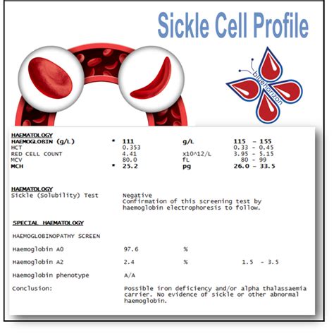 Sickle Cell Blood Test Profile | Blood Tests in London