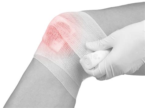 Cotton Bandage Over A Wound On Knee. Stock Image - Image of hurt, healthcare: 30898455