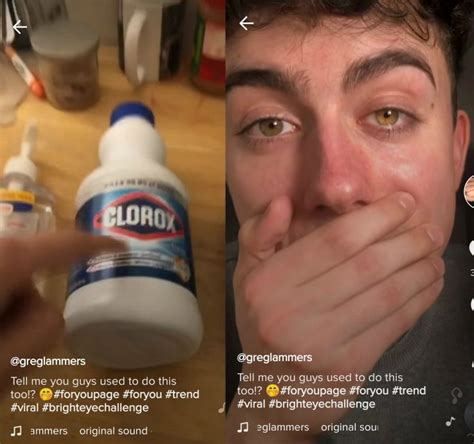 Cos'è la Bright Eye Challenge, la pericolosa sfida su TikTok diventata virale per un video falso