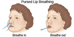 Breathing Labs – Things to know about pursed-lip breathing