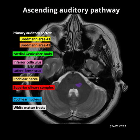 Image | Radiopaedia.org