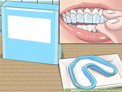 How to Whiten Teeth With Hydrogen Peroxide: 9 Steps