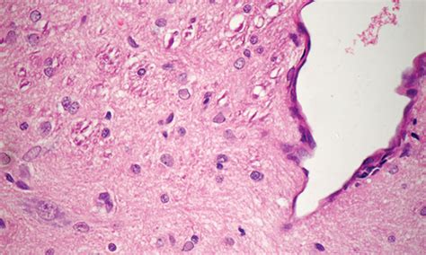 Canine Distemper Virus | Clinician's Brief