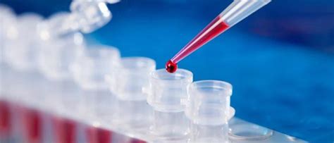 NucleoGene Molecular Detection Assay (Isothermal Amplification Technology)