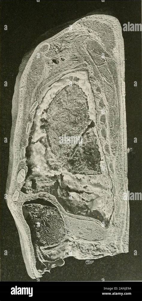 Thoracic wall hi-res stock photography and images - Alamy