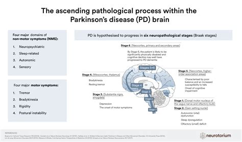 Parkinson's Disease and Braak stages - Neurotorium