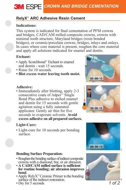 Crown and Bridge Cementation