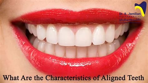 What are the characteristics of aligned teeth? - Dr Jamilian