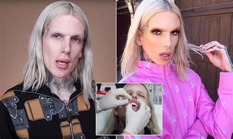 Jeffree Star Before And After