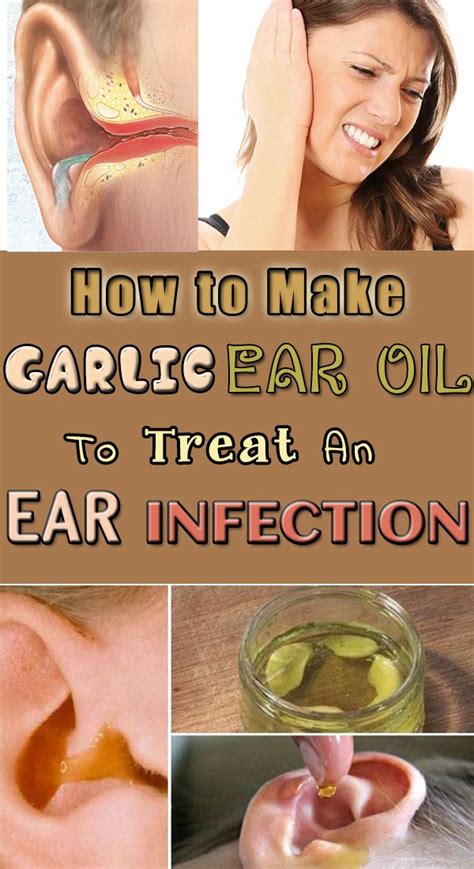 How to Make Garlic Ear Oil to Treat an Ear Infection - First Home Remedy | Ear infection home ...